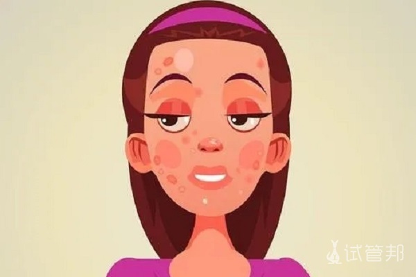 2a57d5126c80acc0626b92bd802329e3.jpg 压力过大会导致不孕症吗?