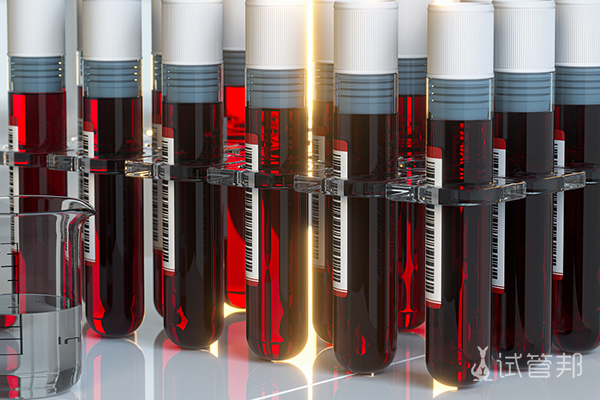 ee38d990b60909698e28f7ccc58e0fec.jpg 熊猫血(rh阴性血)孕妇怎么查抗体