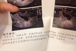 输卵管堵塞，广西南宁试管婴儿顺利好孕