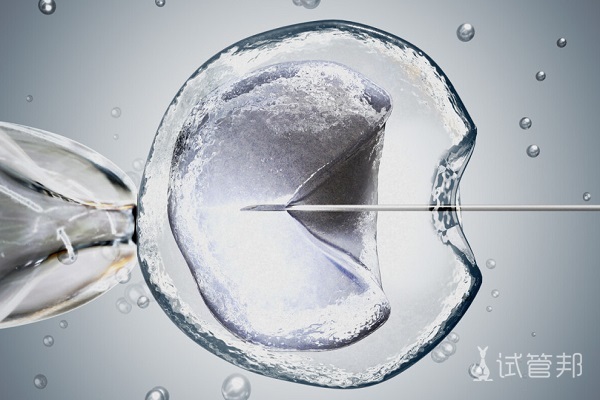 0e3efb6b9a23e40219f7e2b5f4cc376a.jpg 试管婴儿流程有哪些