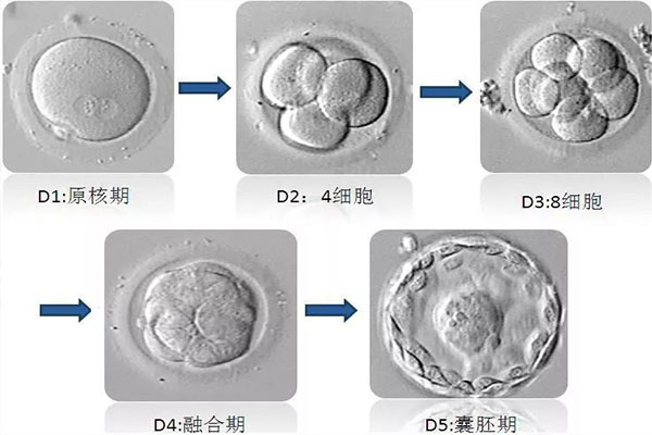 试管婴儿囊胚等级越高越好吗