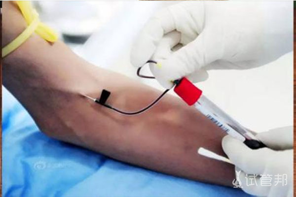 血液HCG测试方法