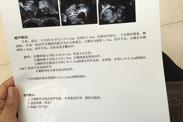 在天津中心妇产医院做试管多少钱