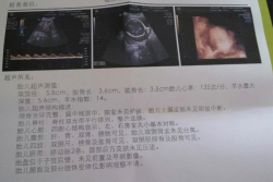 37岁高龄二胎，宁夏妇幼保健院试管婴儿经历记录