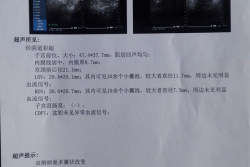 接好孕，深圳市妇幼保健院试管婴儿成功经历