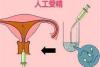 临汾市人民医院可以做人工受精吗？