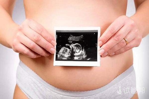 为什么试管婴儿单胚胎移植比多胚移植成功率更高吗？ 
