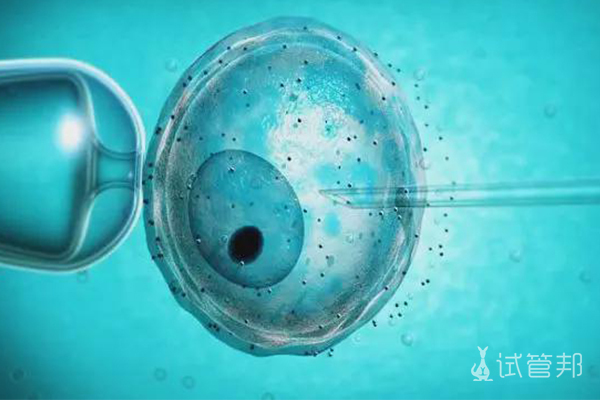 什么是卵胞浆内单精子注射