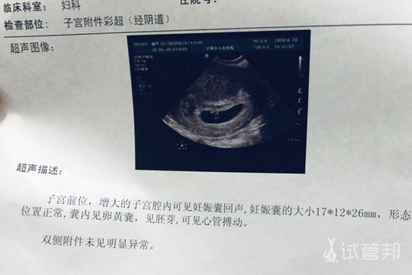 a91a0c714fa443a8b6971e69751bf756.jpg 试管婴儿验孕
