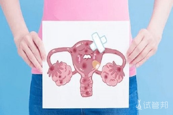 子宫肌瘤会导致女性不孕吗？