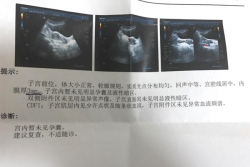 广西试管攻略：桂林市妇幼保健院试管婴儿经验分享