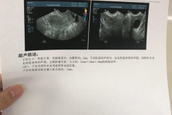 染色体异常，盛京医院试管婴儿好孕经历分享