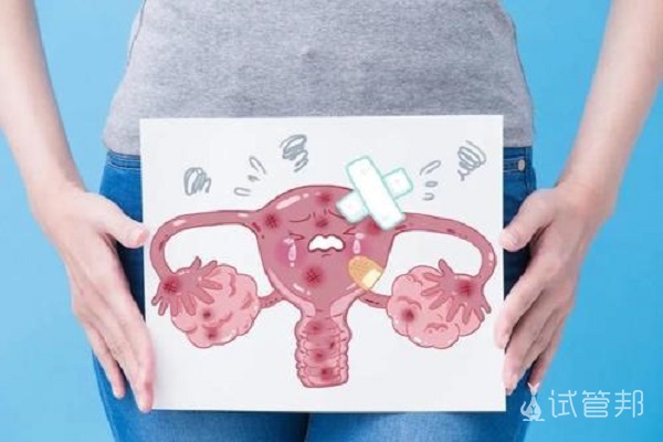 多囊卵巢综合征=不孕？这些症状你中招了吗？