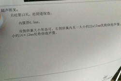 自然流产后，在广西做二代试管婴儿喜获好孕