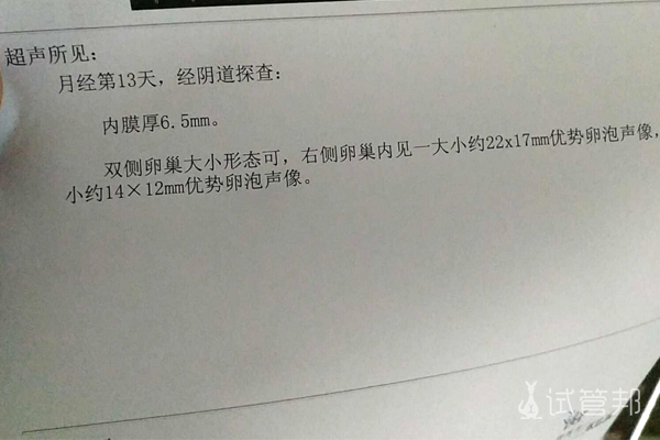 1d79675f28f14b0ba96063c4027cb3e5.jpg 柳州市人民医院试管婴儿技术怎么样