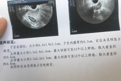武汉康健妇婴医院试管婴儿技术怎么样？成功率高吗