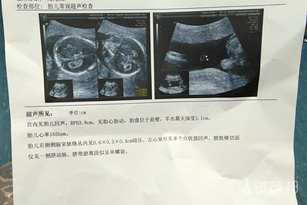 ab5bca25bf9020163a497c906612302a.jpg 27岁反复流产只能选择做试管婴儿