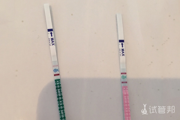 e56cacc266dc92d4d40a1b59611d5357.jpg 新疆医科大学第一附属医院试管婴儿经历