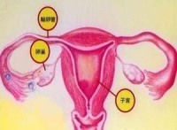卵巢畸胎瘤要做哪些检查？