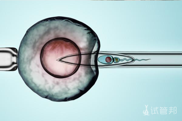 ba8cbc0dcc4954bbe73143824757281e.jpg 取卵手术过程是怎样的