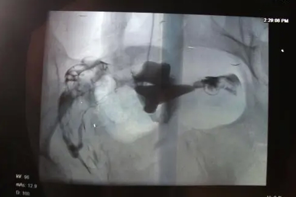 6f74c34e6c760b9456ba33de950fa417.png 两次试管婴儿失败怎么办