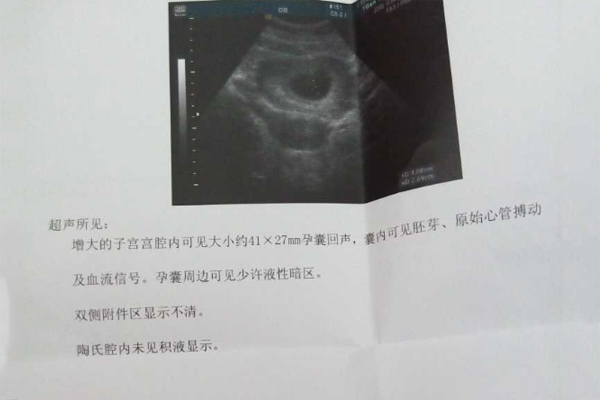 多次流产怀孕难，陕西省人民医院试管婴儿喜得宝宝