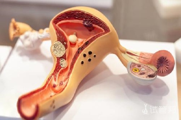 780c8efd2674f5b778e347227bcd0113.jpg 巧克力囊肿会导致不孕不育吗,拿什么来拯救?