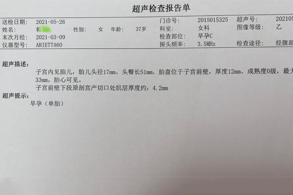 深圳市人民医院试管婴儿3次移植，终于成功好孕