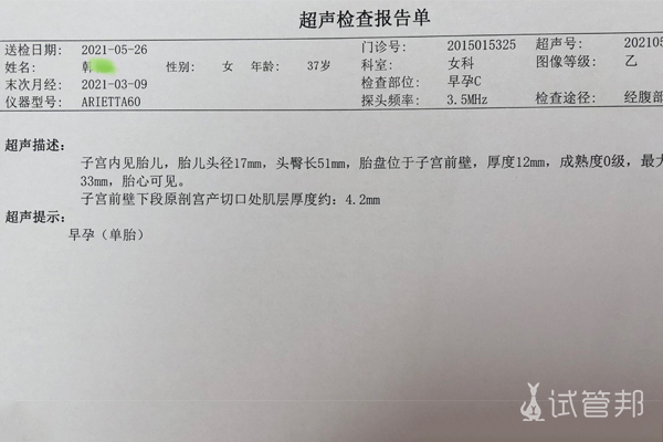 深圳市人民医院试管婴儿3次移植