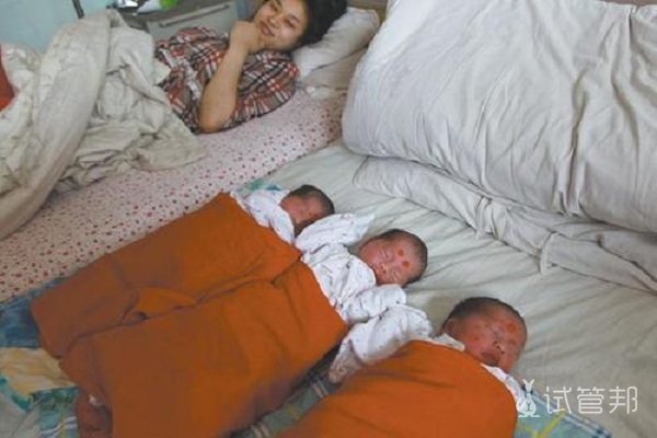 三胞胎怀孕是什么样的经历