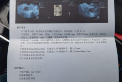 试管移植4次才成功，希望我的试管婴儿日记对你有用