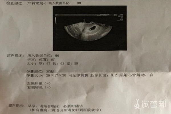 c532060150ef10d5bb49d88996266b54.jpg 胎梦与生男生女有关系吗