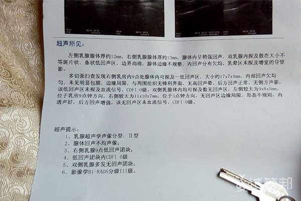 a03f237fd6153f1322344ccb3b7a3750.jpg 试管婴儿移植失败