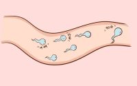 精子活动率低会导致胎停吗？