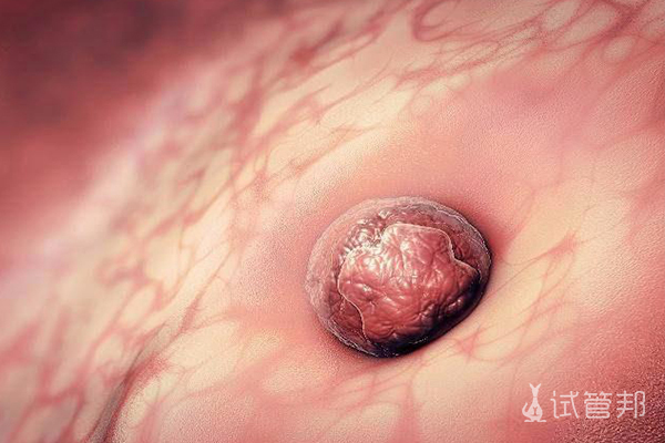胚胎着床一般是在孕几周