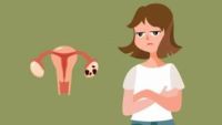 卵巢性闭经导致月经不正常，请问卵巢性闭经严重吗？