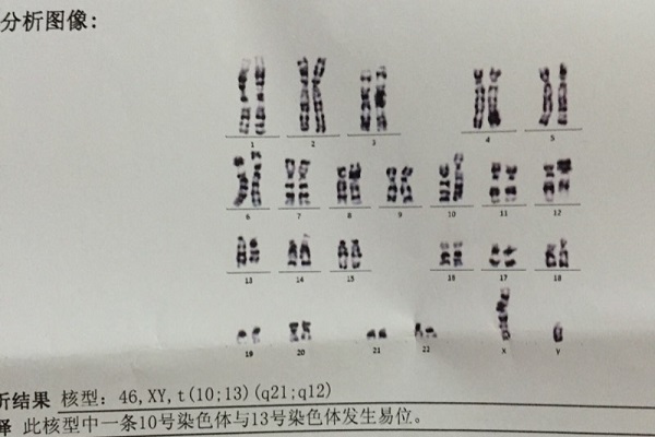 染色体异常胎停