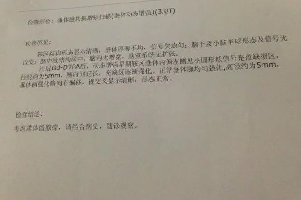 催乳激素高磁共振检查