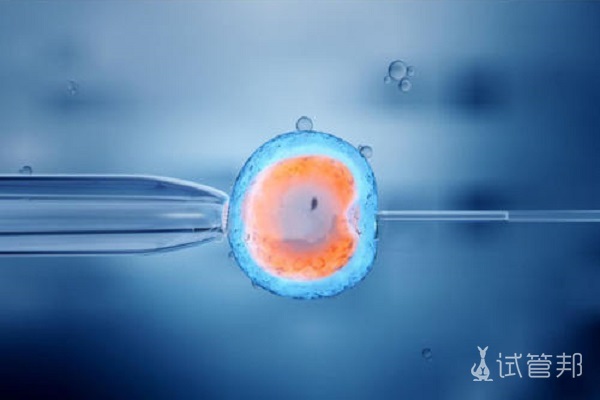 胚胎培养需要注意些什么？