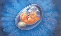 卵黄囊和孕囊的区别是什么？