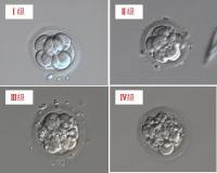 做试管婴儿的胚胎，怎么看胚胎的等级？