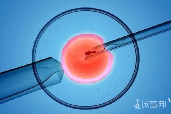 子宫内膜息肉在试管之前需要治疗吗？