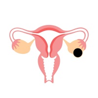 妇科检查出卵巢畸胎瘤，请问卵巢畸胎瘤有什么影响和危害？