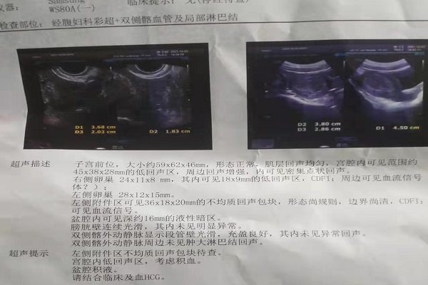 孕前检查有哪些注意事项