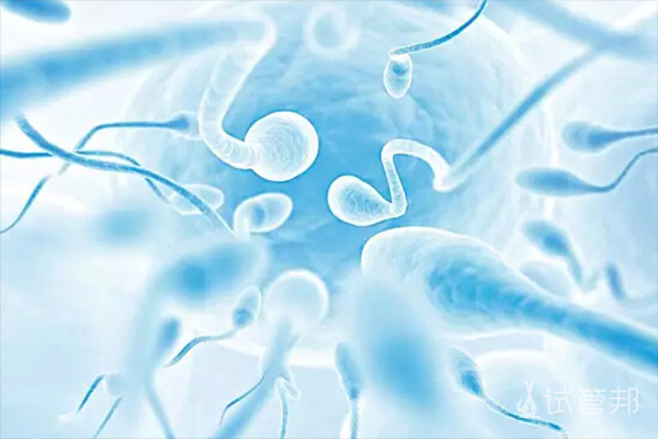 哪种精子符合做试管婴儿的要求
