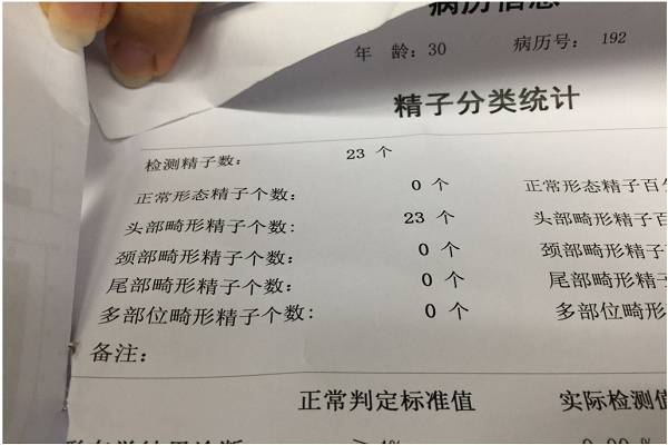 精子畸形检查报告