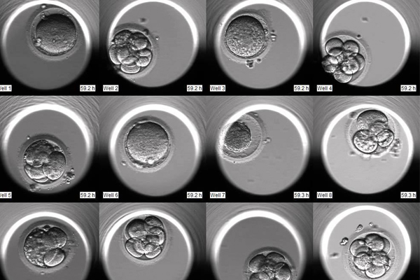 试管婴儿胚胎培养结果
