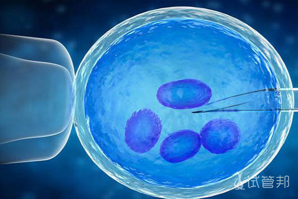 fb664ebff5a83f6fffb3bc607cfdcaee.jpg 试管婴儿移植的两种方法