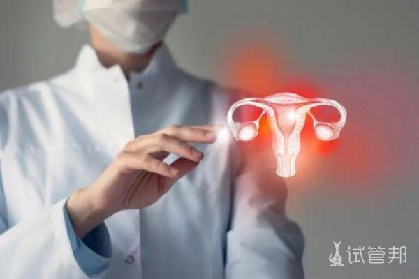 多囊卵巢综合症的治疗方法有哪些？