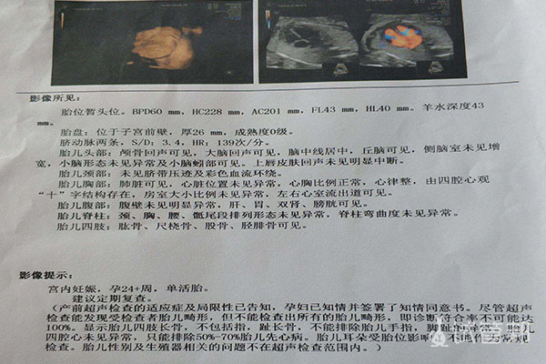 9e443c9e7a2b3144d776f77e10f81446.jpg 胎盘成熟度与孕周标准